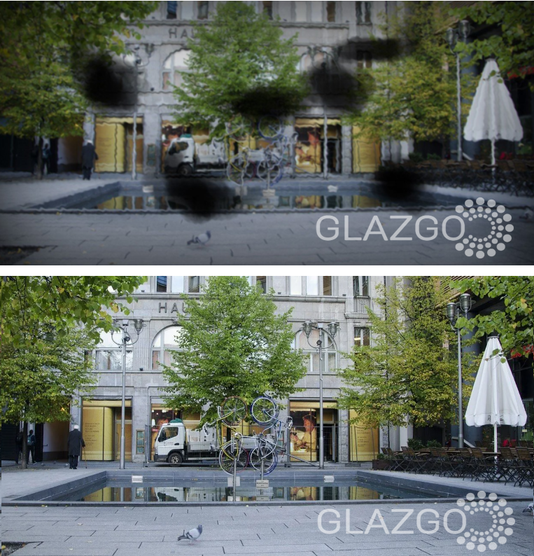 Разрыв сетчатки лечение