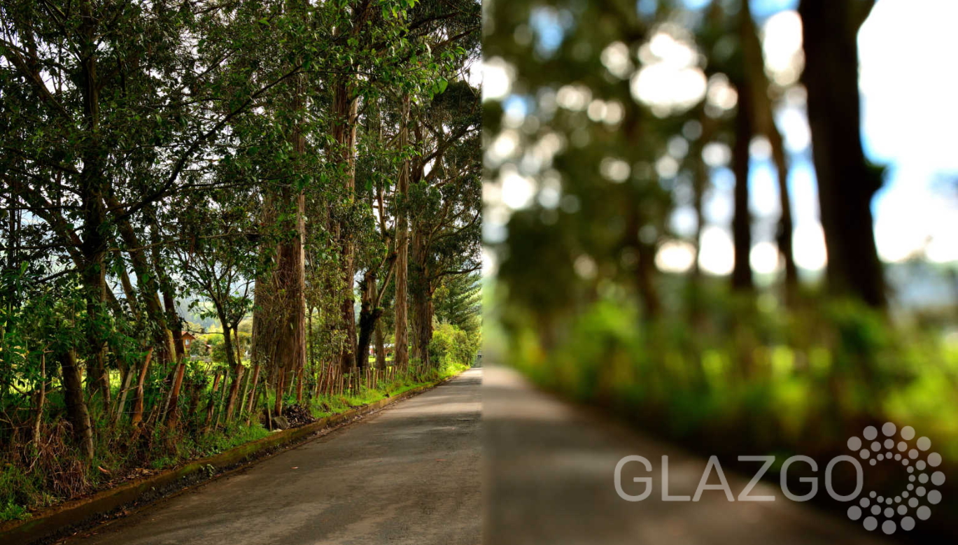 Лечение близорукости высокой степени без операции