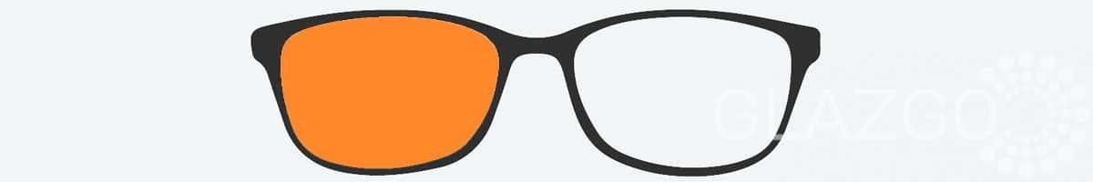 амбліопія ледаче око лікування