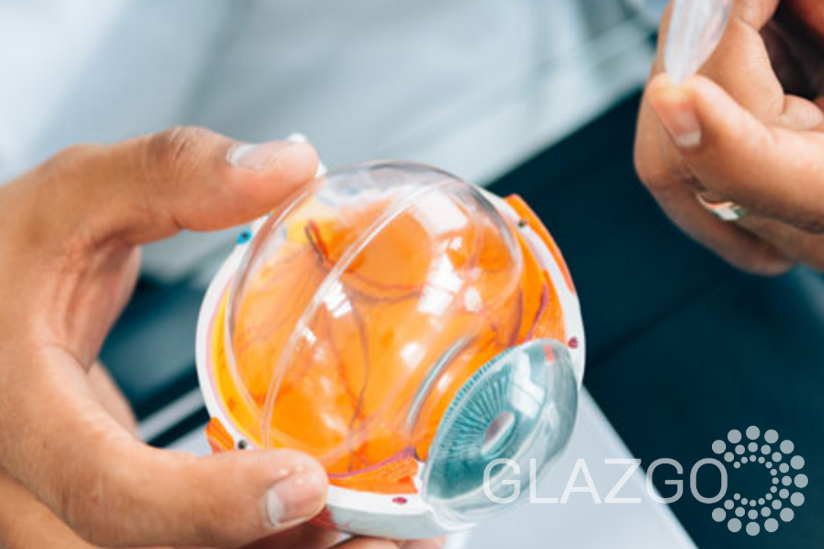 Деструкция стекловидного тела причины и симптомы