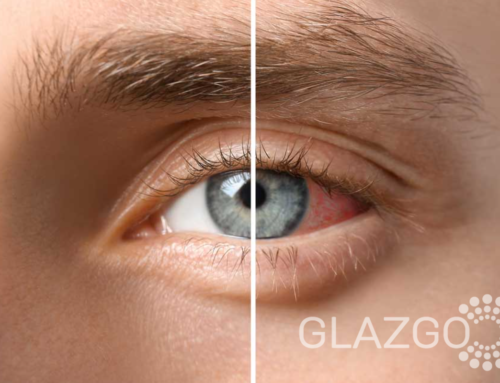 Что такое увеит глаза? Причины, симптомы и лечение заболевания