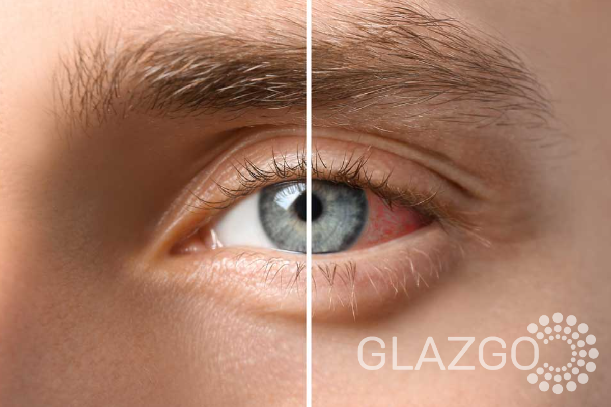 уевит глаза